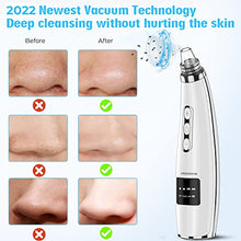 Load image into Gallery viewer, 2022 Newest Blackhead Remover Pore Vacuum,Upgraded Facial Pore Cleaner,Electric Acne Comedone Whitehead Extractor Tool-5 Suction Power,5 Probes,USB Rechargeable Blackhead Vacuum Kit for Women &amp; Men
